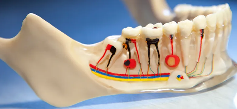 Root canal treatment