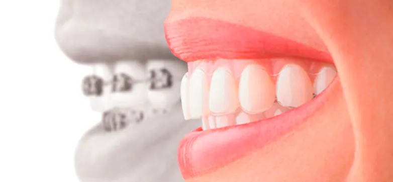 Orthodontics at South Dental